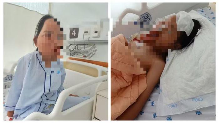 Bảo Thi trước và sau ca phẫu thuật. (Ảnh: Gia đình cung cấp)
