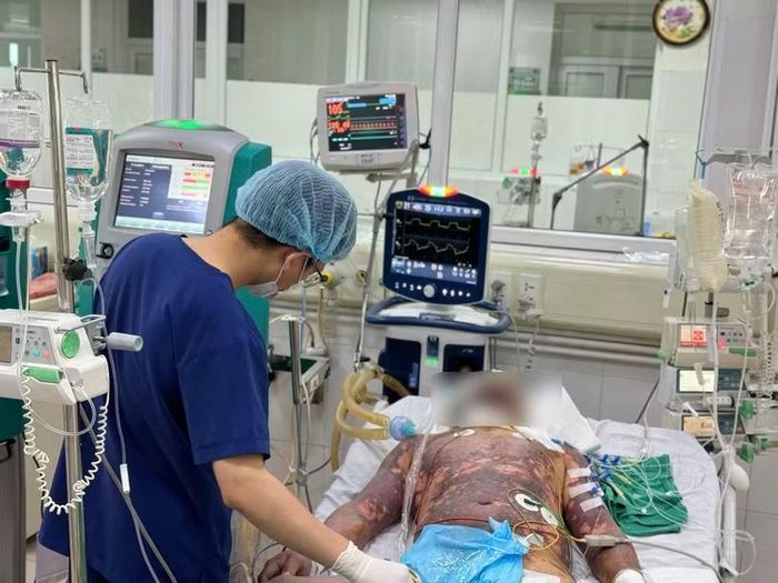 Bệnh nhân liên cầu lợn trong tình trạng nguy kịch. Ảnh: Minh Thanh.
