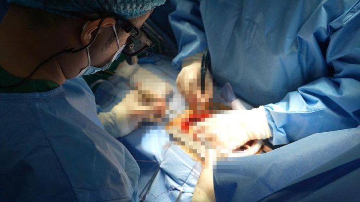 Bệnh viện C Đà Nẵng lần đầu phẫu thuật tim bắc cầu động mạch vành