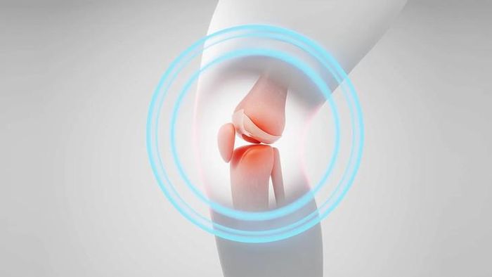 Thủ thuật thuyên tắc động mạch gối, viết tắt là GAE, đang trở thành một hướng đi mới thu hút sự chú ý của giới chuyên môn. Ảnh minh họa: Younify Clinic