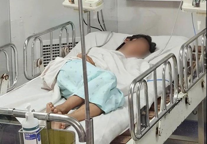 Bệnh nhân mắc não mô cầu điều trị tại Bệnh viện Bệnh Nhiệt đới TPHCM. Ảnh: BVCC.