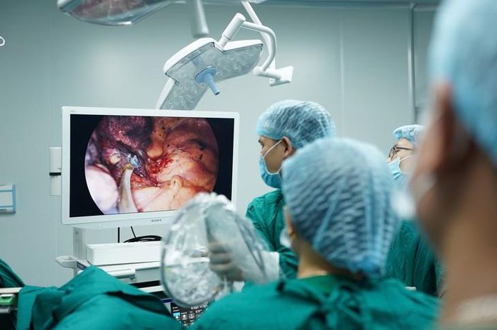 Ê-kíp bác sĩ thực hiện phẫu thuật nội soi lồng ngực có hỗ trợ, theo dõi hình ảnh phẫu thuật trên màn hình trong quá trình cắt kén khí màng phổi. ẢNH: K. H