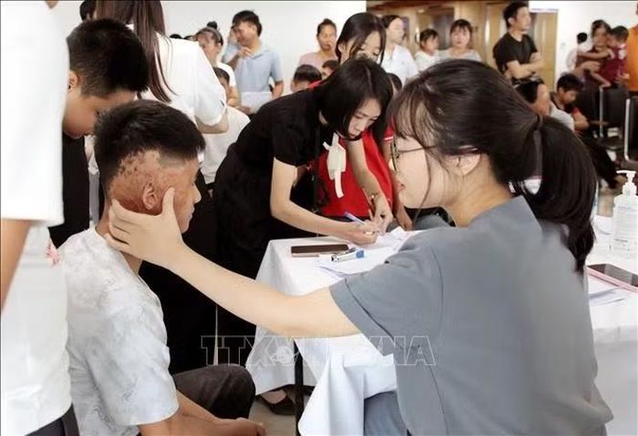 Bác sĩ thăm khám, kiểm tra tình trạng sức khỏe và đánh giá các tổn thương do bỏng, dị tật tay chân ở trẻ trước khi phẫu thuật.