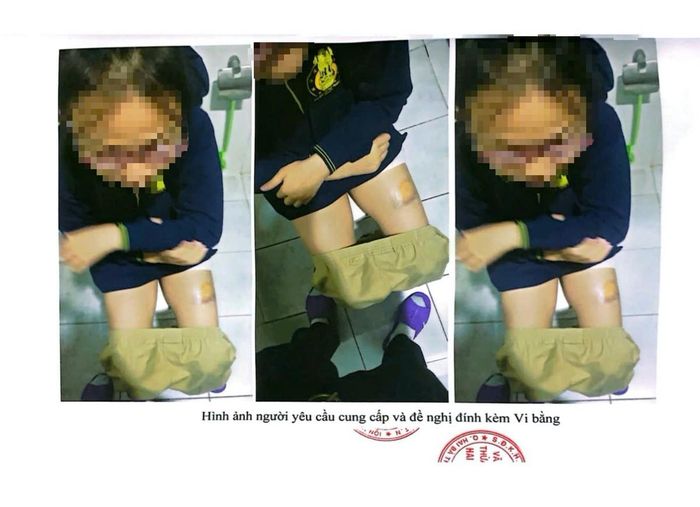 Việc M.C bị đánh được chị Hạnh lập vi bằng.