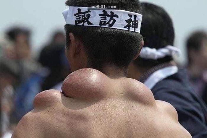 Khối chai sần khổng lồ (Mikoshi dako) nổi phồng trên vai một người gánh kiệu lâu năm – minh chứng cho nhiều thập kỷ phụng sự thần linh. Ảnh: Oddity Central