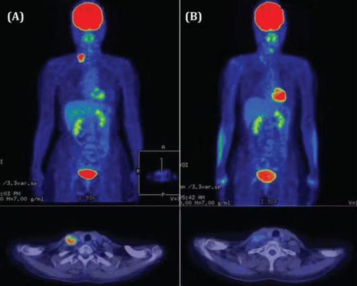 Bài toán vì thế không chỉ là mua thêm máy PET/CT mà phải hình thành được hệ thống cung ứng thuốc tương ứng. Nếu chỉ đầu tư thiết bị mà không giải quyết được nguồn dược chất, nguy cơ lãng phí nguồn lực và hạn chế cơ hội tiếp cận kỹ thuật của người bệnh vẫn còn. Ảnh: Vinmec