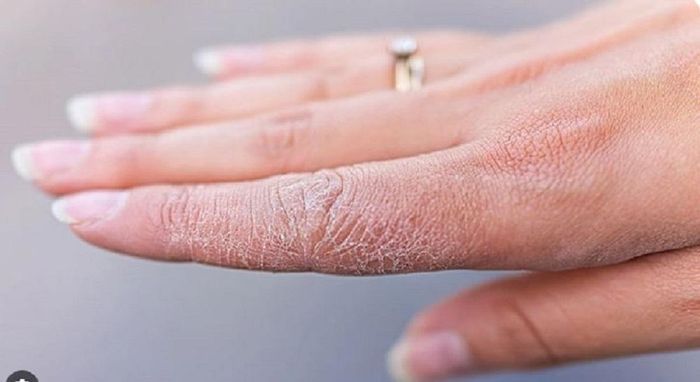 Sử dụng chất tẩy rửa mạnh đôi khi khiến bàn tay của những người làm nội trợ trở nên thô ráp.