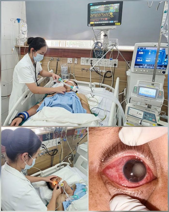 Các bác sĩ thăm khám và chăm sóc cho các bệnh nhân - Ảnh BVCC