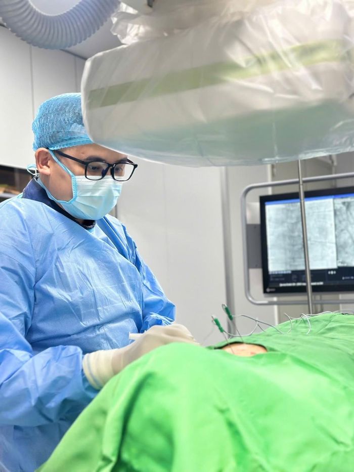Đốt sóng cao tần xung (PRF) là kỹ thuật ít xâm lấn tác động chọn lọc lên hạch rễ sau của dây thần kinh chi phối vùng đau. Ảnh: Bệnh viện Bưu điện