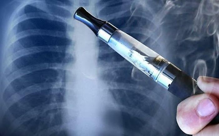 Có bệnh nhân bị tràn khí màng phổi, xẹp phổi sau khi sử dụng thuốc lá điện tử