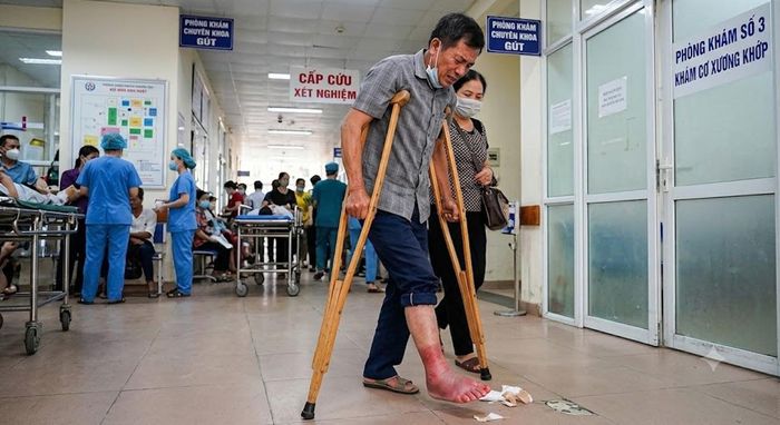 Sau bát canh măng chua nấm, người đàn ông phải vào viện cầu cứu bác sĩ. Ảnh: AI