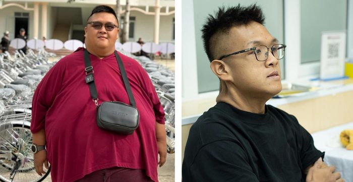 Bệnh nhân trước và sau khi giảm cân. Ảnh: NVCC