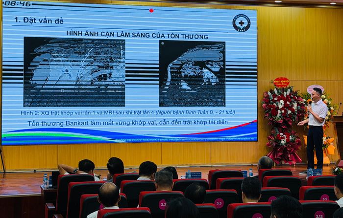  Bác sĩ chia sẻ về một ca chấn thương thể thao phức tạp 