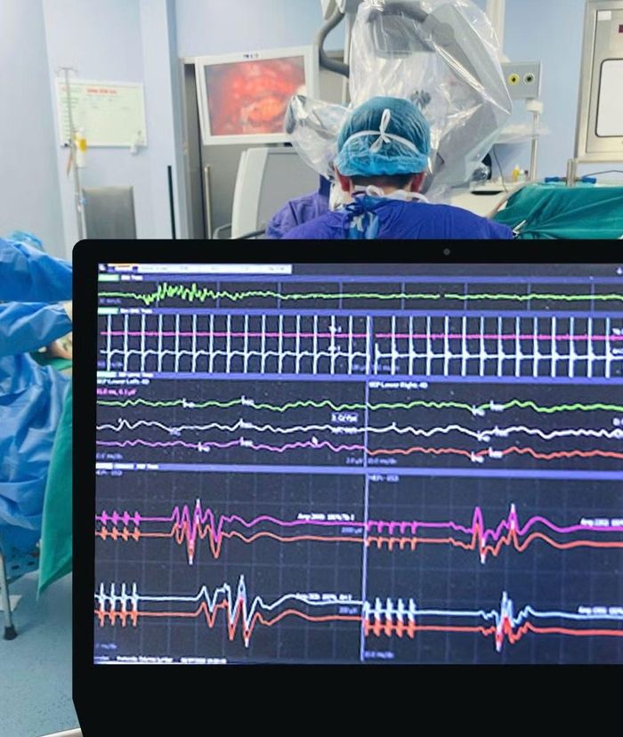 Hệ thống NIM theo dõi điện cơ thần kinh trong mổ. Ảnh BVCC