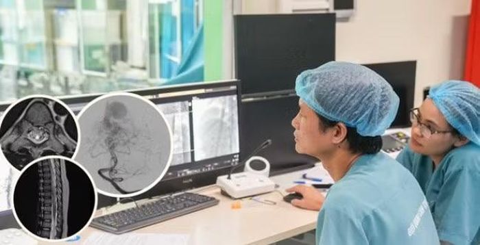 Tại Bệnh viện Nhi Trung ương, qua thăm khám, chụp cộng hưởng từ (MRI) và chụp mạch số hóa xóa nền (DSA), các bác sĩ phát hiện trẻ mắc dị dạng mạch máu tủy sống kéo dài từ D8 đến D12.