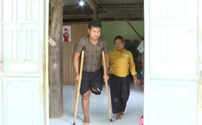 Em Kpă Chiến mong ước có chiếc chân giả để thuận tiện hơn trong sinh hoạt, san sẻ gánh nặng cùng gia đình. Ảnh: Viễn Khánh