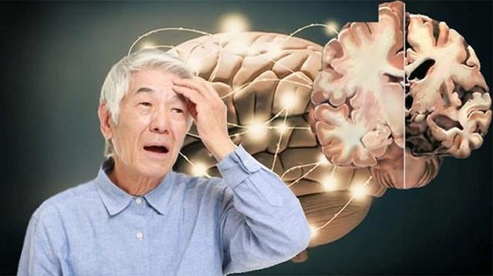 Biểu hiện đặc trưng là suy giảm các lĩnh vực nhận thức như trí nhớ, chú ý, định hướng, ngôn ngữ, trí giác, suy luận, điều hành, và khả năng thực hiện các nhiệm vụ liên tục.