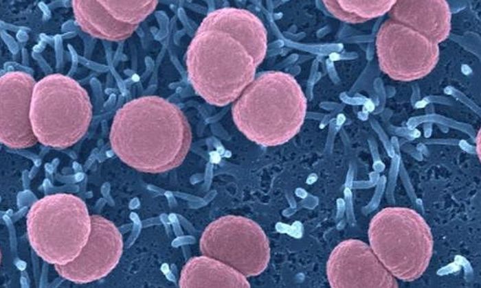 Vi khuẩn não mô cầu (Neisseria meningitidis) có nhiều nhóm huyết thanh khác nhau. Người từng mắc bệnh vẫn có thể tái nhiễm do những nhóm vi khuẩn khác. Ảnh: Institut Pasteur.