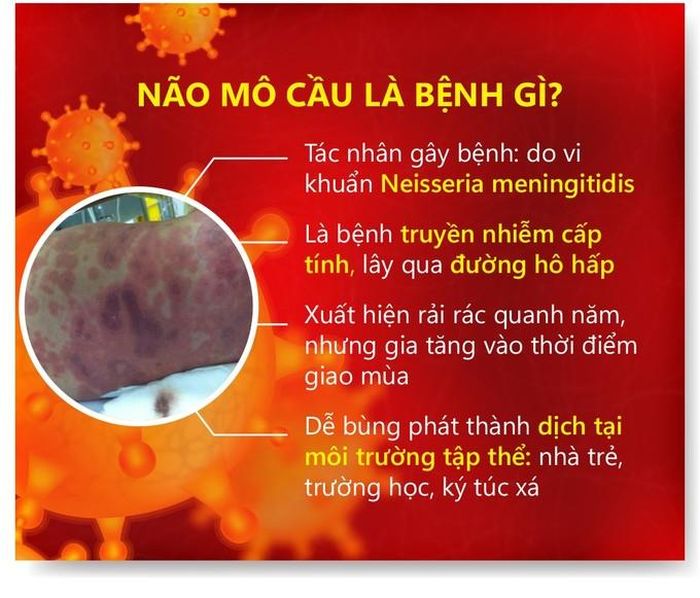  Thông tin về bệnh do não mô cầu 