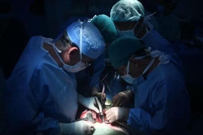 Các bác sĩ của Bệnh viện Nhi đồng 2 TPHCM thực hiện phẫu thuật trong một ca ghép gan vào năm 2025- Ảnh BV