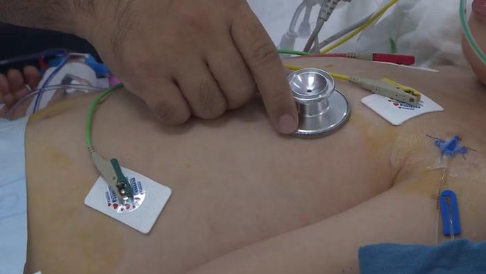 Bệnh nhân mắc não mô cầu dễ rơi vào trạng thái sốc, suy đa tạng chỉ trong vài ngày nếu không được điều trị kịp thời.(Ảnh: THÚY QUỲNH)