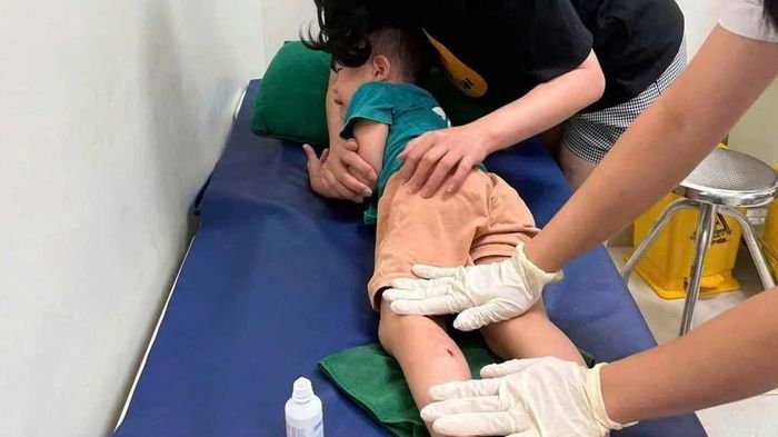Khỉ hoang tấn c&ocirc;ng trẻ em ở bi&ecirc;n giới Lạng Sơn