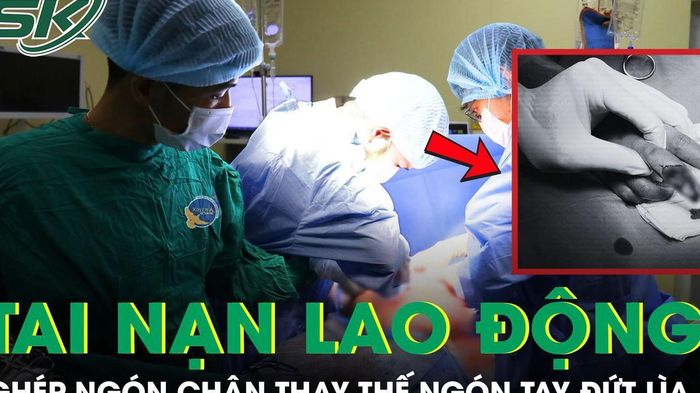 Nữ c&ocirc;ng nh&acirc;n bị đứt l&igrave;a ng&oacute;n tay do m&aacute;y cắt giấy, phải gh&eacute;p ng&oacute;n ch&acirc;n thay thế