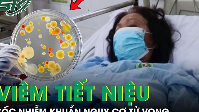 Người phụ nữ sốc nhiễm khuẩn, suy đa cơ quan, nguy cơ tử vong cao sau 3 ng&agrave;y sốt, ho