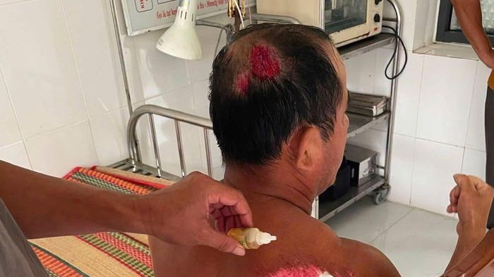 Ngư d&acirc;n c&acirc;m điếc bị t&agrave;u lạ t&ocirc;ng ch&igrave;m thuyền rồi bỏ mặc giữa biển